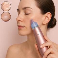 Vacuum Suction Tool with 4 Suction Head for Men and Women (Multi-Color / 1 Set) (USB & Adapter Included)